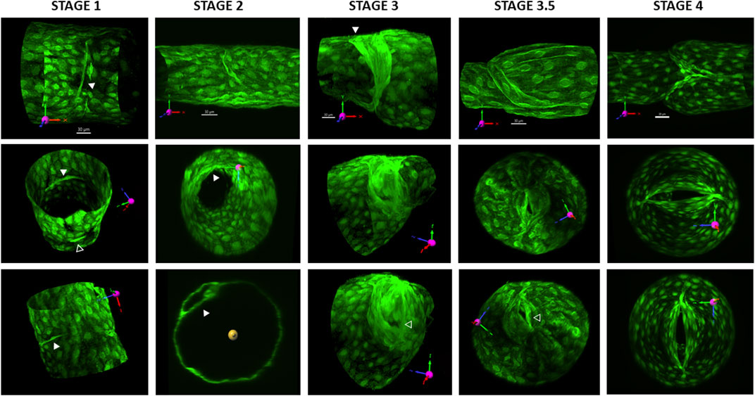 Developmental progression of lymphatic valve morphology and function